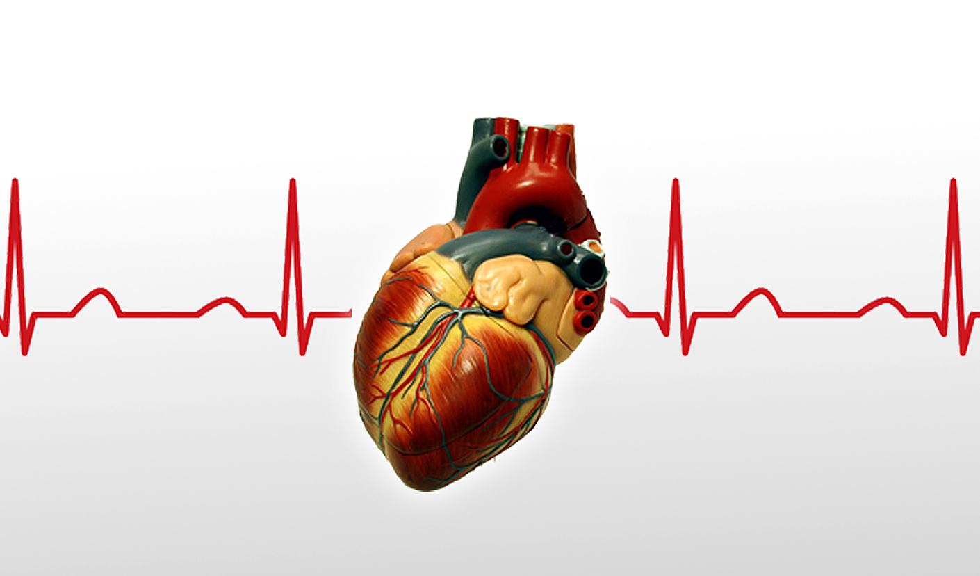 Cardiovascular disease (CVD) in Women