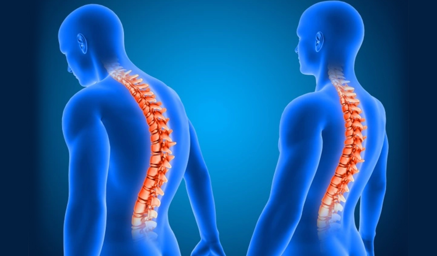 Suffering from stiff back?? know the causes cause of severe back pain and its remedies